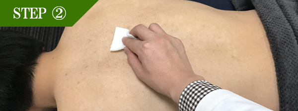 背中上脱毛Step2