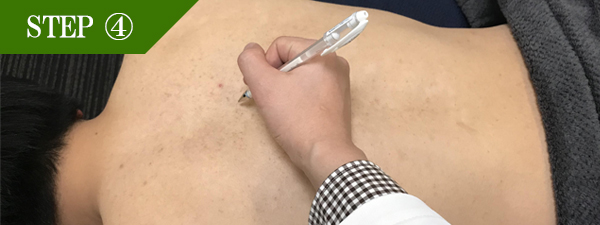 背中上脱毛Step4