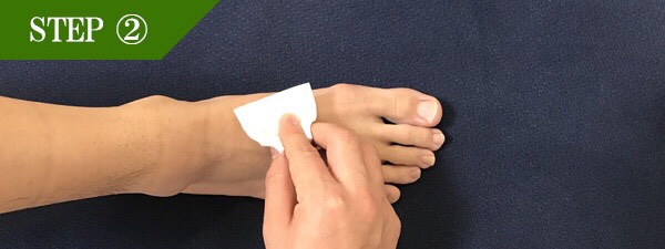 足の甲脱毛Step2