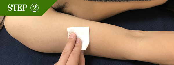 ひじ上脱毛Step2
