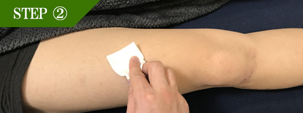 ひざ上脱毛Step2
