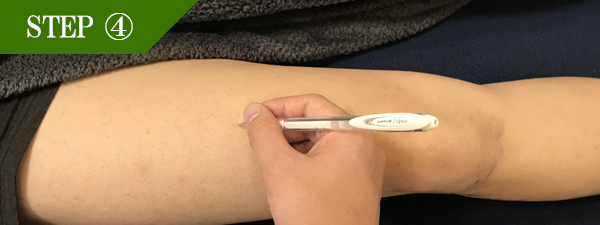 ひざ上脱毛Step4