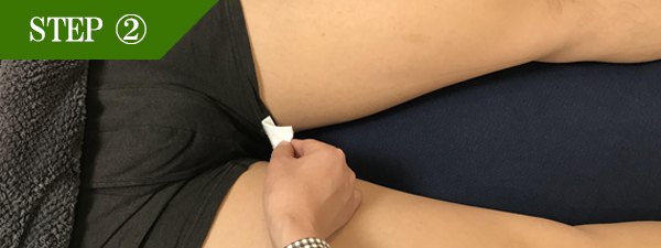 Ｉライン脱毛Step2