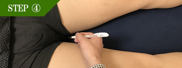 Ｉライン脱毛Step4