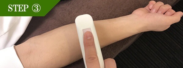 口下ヒゲ脱毛Step3