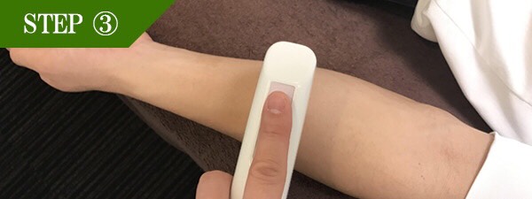 もみあげ脱毛Step3