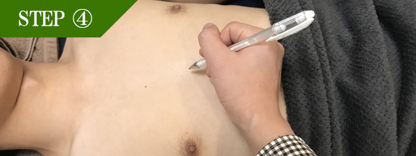 胸元脱毛Step4