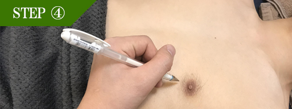 乳輪周りの脱毛Step4