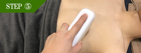 乳輪周りの脱毛Step5