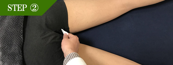 Ｏラインページ脱毛Step2