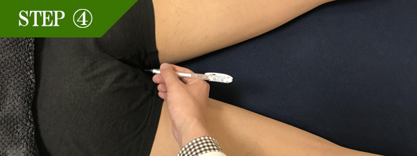 Ｏラインページ脱毛Step4