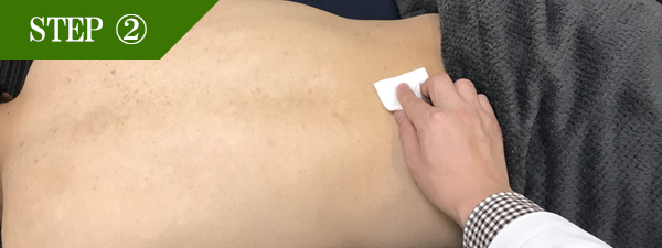 背中下脱毛Step2