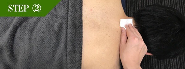 うなじ脱毛Step2