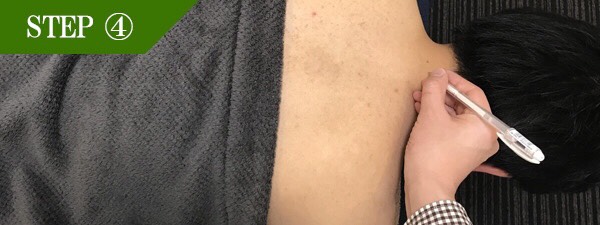 うなじ脱毛Step4