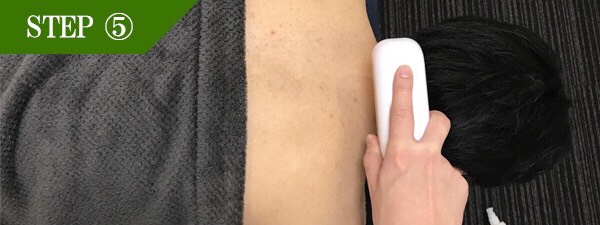 うなじ脱毛Step5