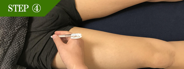 Vライン脱毛Step4