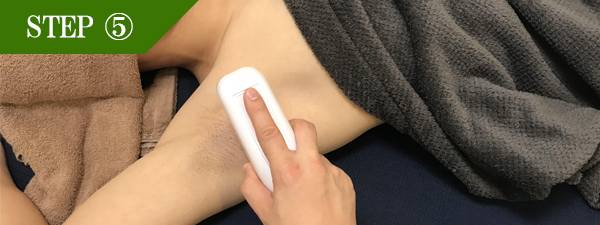 ワキ脱毛Step5